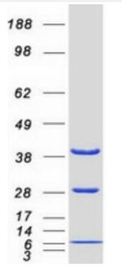 SDS-PAGE (DNAJB1-1382HFL).jpg